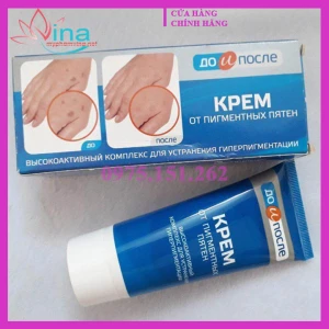 Kem Dưỡng Da Tay Kpem Sạch Đồi Mồi, Vết Nám, Sạm, Đốm Nâu 50ML