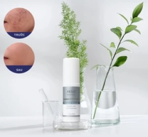 Kem dưỡng Obagi Clenziderm M.D. Therapeutic Moisturizer - 50ml