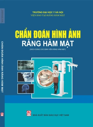 Chẩn đoán hình ảnh Răng hàm mặt