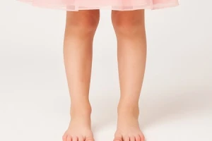 Nguyên nhân và cách khắc phục chân vòng kiềng