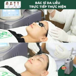 Điều Trị Nám Bằng Laser RevLite Điện Di Matrix Repair