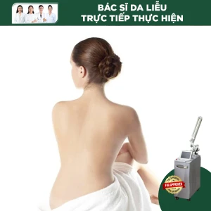 Điều Trị Sắc Tố Vùng Lưng Bằng Laser Revlite