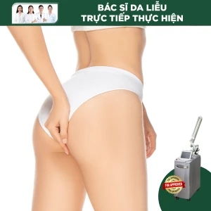 Điều Trị Sắc Tố Vùng Mông Bằng Laser Revlite