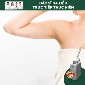 Điều Trị Sắc Tố Vùng Nách Bằng Laser Revlite