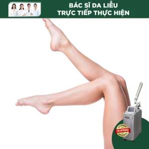 Điều Trị Sắc Tố Vùng Nửa Chân Bằng Laser Revlite