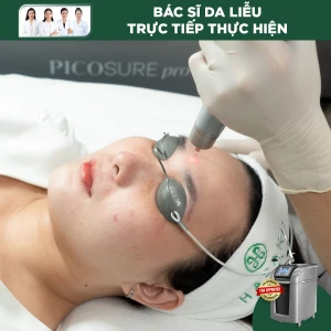 Điều Trị Sẹo Mụn Bằng Laser Pico Pro