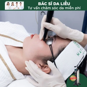 Điều Trị Tàn Nhang Bằng Laser CO2 (1 Nốt)