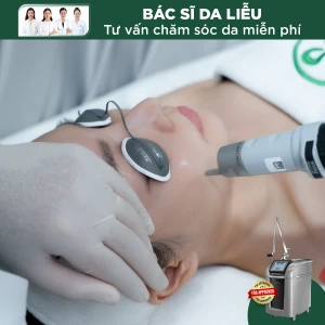 Điều Trị Tàn Nhang Bằng Laser Pico Pro (1 nốt)