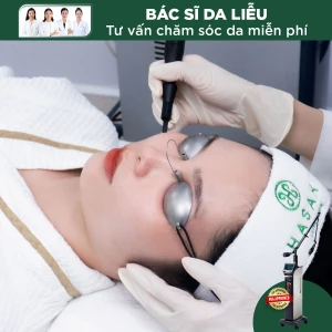 Điều Trị Tàn Nhang Toàn Má Bằng Laser CO2