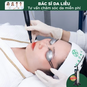 Điều Trị Tàn Nhang Toàn Mặt Bằng Laser CO2