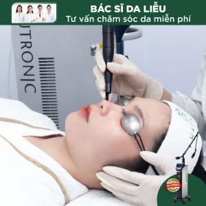 Điều Trị Tàn Nhang Vùng Gò Má Bằng Laser CO2