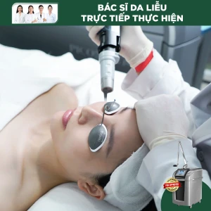 Điều Trị Tăng Sắc Tố Bằng Laser Pico Pro