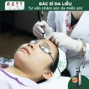 Đốt U Ống Tuyến Mồ Hôi - Mụn Thịt Bằng Laser CO2