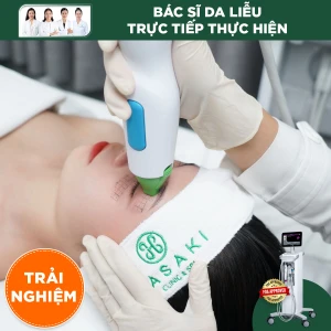 Săn Da, Xoá Nhăn Đa Tầng Vùng Mắt Thermage FLX (Trải nghiệm)