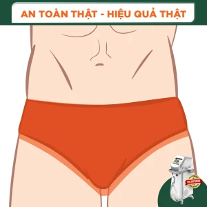Triệt Lông Bikini Nam (1 Buổi)