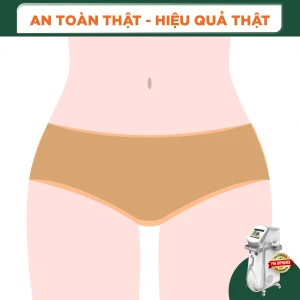 Triệt Lông Bikini Nữ Diode Laser (10 Buổi) (Bảo Hành 5 Năm)