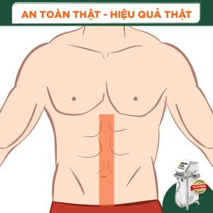 Triệt Lông Đường Thẳng Bụng Nam Diode Laser (10 Buổi) (Bảo Hành 5 Năm)