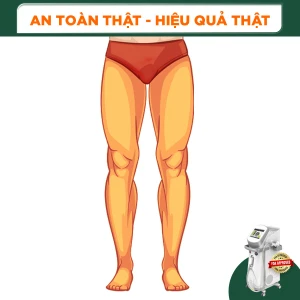 Triệt Lông Nguyên Chân Nam Diode Laser (10 Buổi) (Bảo Hành 5 Năm)