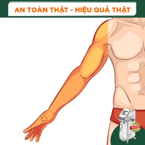 Triệt Lông Nguyên Tay Nam Diode Laser (10 Buổi) (Bảo Hành 5 Năm)