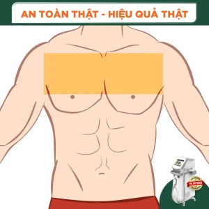 Triệt Lông Nửa Ngực Nam (1 Buổi)