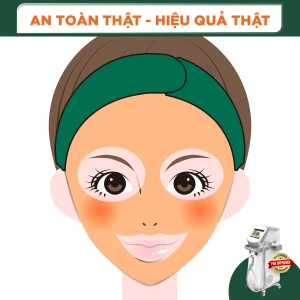 Triệt Lông Toàn Mặt Nữ Diode Laser (8 Buổi) (Bảo Hành 5 Năm)