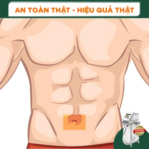 Triệt Lông Viền Rốn Nam Diode Laser (10 Buổi) (Bảo Hành 5 Năm)