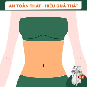 Triệt Lông Vùng Bụng Nữ Diode Laser (8 Buổi) (Bảo Hành 5 Năm)