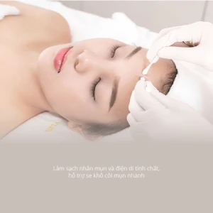 Loại bỏ mụn cấp độ nhẹ