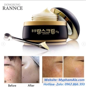 KEM TRỊ NÁM CAO CẤP DONGSUNG RANNCE CREAM HÀN QUỐC