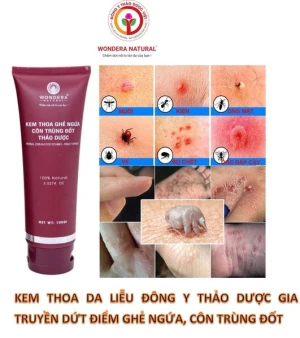 Kem thoa ghẻ ngứa côn trùng đốt thảo dược 100G