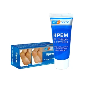 Kem Hỗ Trợ Giảm Nứt Gót Chân Kpem Apteka 50ml