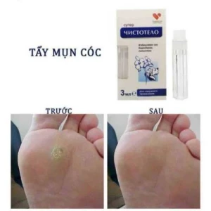 Gel Tẩy Nốt Ruồi Mụn Cóc Mụn Thịt Dvelinil 3ml - 0967227889