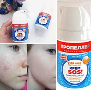 Kem Trị Mụn Cấp Tốc SOS 50ml Nga