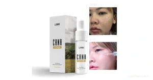 Serum dưỡng phục hồi da hư tổn do mụn Lanos Cana